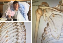 Wilde’s wince worthy bike crash update underscores long rehab ahead